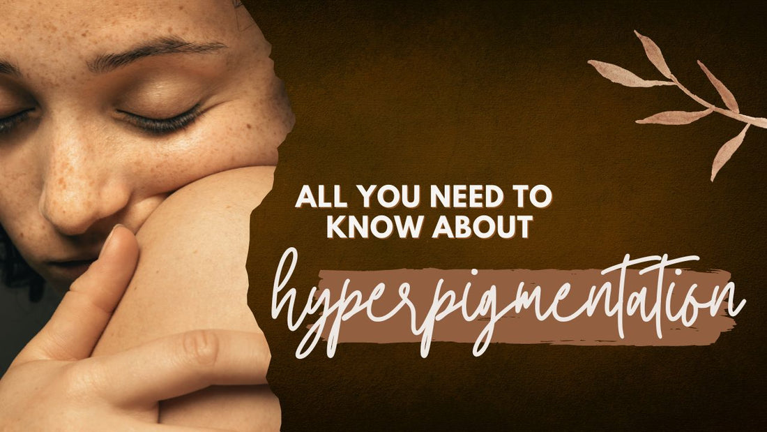 Understanding Hyperpigmentation    - Causes, Remedies and Natural Ingredients to the Rescue!